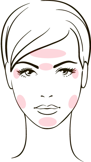 ボトックス注入対応部位