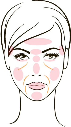 ヒアルロン酸注入対応部位