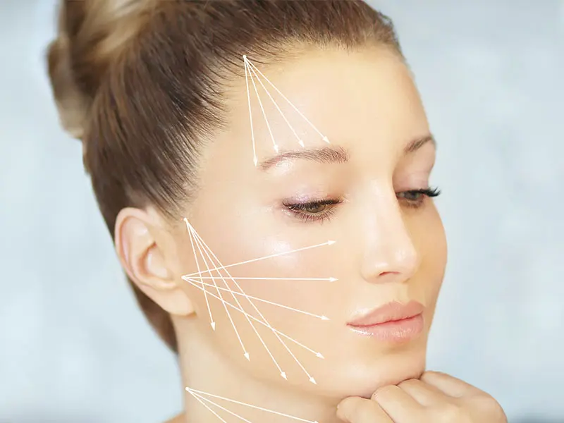 ヒアルロン酸注入の施術を受ける女性